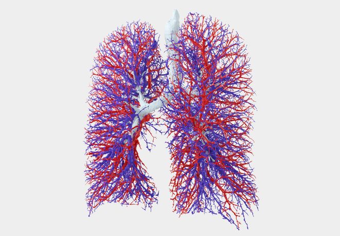 Fluidda - Functional Respiratory Imaging (FRI) Technology