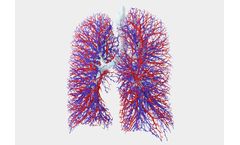 Fluidda - Functional Respiratory Imaging (FRI) Technology