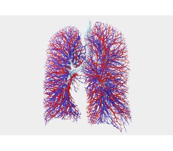 Fluidda - Functional Respiratory Imaging (FRI) Technology