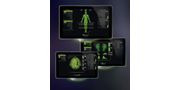 32-Channel Neuromonitor for Neuro- and Spine Surgery