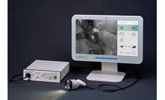 Model Fluobeam Lx - The Ultimate Camera for Monitoring In Parathyroid Surgery