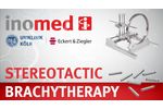 Stereotactic Brachytherapy for Brain Tumors ??? surgical workflow ??? inomed - Video