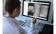 Intellijoint VIEW - Web-Based Surgical Planning Solution