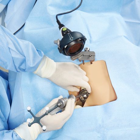 Intellijoint HIP - Surgeon-Controlled, Navigation Tool for Total Hip Arthroplasty (THA)