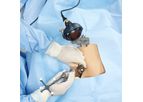 Intellijoint HIP - Surgeon-Controlled, Navigation Tool for Total Hip Arthroplasty (THA)