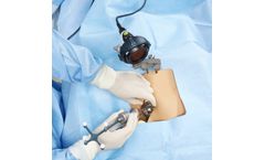 Intellijoint HIP - Surgeon-Controlled, Navigation Tool for Total Hip Arthroplasty (THA)