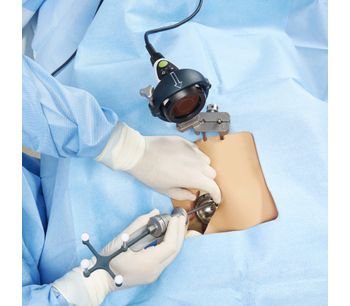 Intellijoint HIP - Surgeon-Controlled, Navigation Tool for Total Hip Arthroplasty (THA)