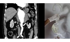 Axial3d - Solution for Interventionalists