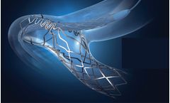 Tryton - Side Branch Stent