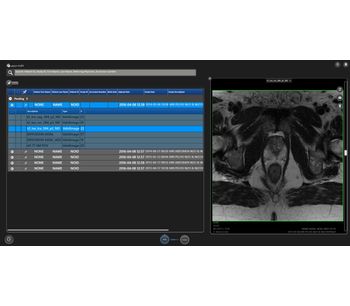 Software for Interpreting MRIs of the Prostate-1