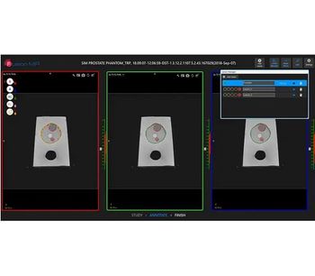 Fusion - Version MR - Software for Interpreting MRIs of the Prostate