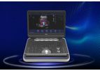 Focus & Fusion - Model Finus Series - Ultrasound Imaging System