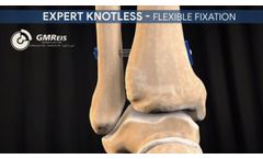 3D Animation: Expert Knotless - Flexible Fixation - Video