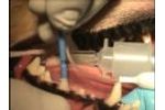 SANOS Veterinary Dental Sealant Application - Video