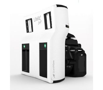 LifeViz - Model Body - Portable 3D Imaging System for Body & Breast