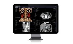 Xelis - 3D Diagnosis Support Solution