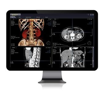 Xelis - 3D Diagnosis Support Solution