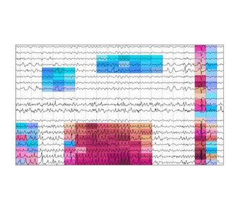 Beacon - EEG Analytics Platform