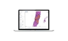 Aiforia - Clinical AI Model for Prostate Cancer, Gleason Grade Groups