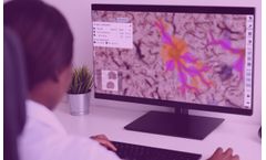 Aiforia - Create for Cloud-Based AI Software for Image Analysis