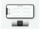 KardiaMobile - Model 6L - EKG Device with KardiaCare