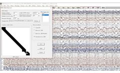fMRI EEG Gradient Artifact Correction In BESA Research - Video