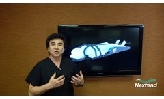 Bone Foam Anterior Cervical Patient Positioning - Nextend - Video