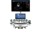 CHISON - Model XBit 90 - Premium Ultrasound System