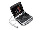CHISON SonoBook - Model 9 - Portable Ultrasound Machine