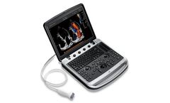 CHISON SonoBook - Model 9 - Portable Ultrasound Machine