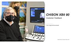 Listen how customer describe CHISON XBit90 - Video