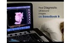 CHISON SonoBook9-Diagnostic Ultrasound Images - Video