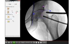 Surgeon Checklist - Version PAO - Minimally-Invasive Solutions for Hip Preservation