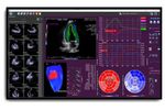 Medis Suite - Ultrasound Software