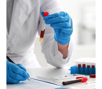 PancreaDix - Non-Invasive Signature in Blood Test Cutting Edge Liquid Biopsy Technology