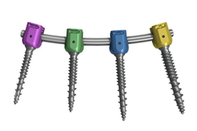 Threshold - V2 - Pedicular Fixation - Open Systems