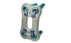 AccuFit - Model ALIF - Lumbosacral Fixation Plate System