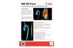 Caas - Version MR 4D - Complete Flow Assessment Software - Brochure
