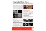 3mensio - Mitral Valve Regurgitation Software - Brochure