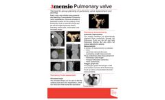 3mensio - Percutaneous Pulmonary Valve Implantation (PPVI) Planning Software - Brochure