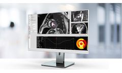 Caas - Functional MRI Images Analysis Software