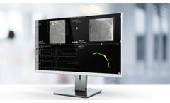 Caas - Version vFFR - Workstation Software for Novel Angio-Based Functional Lesion Assessment