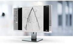 Caas - Version QVA - Quantitative Vascular Analysis Workstation Software