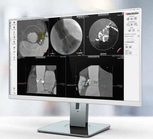 3mensio - Aortic Valve Replacement Software