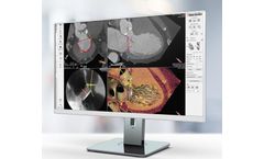 3mensio - Mitral Valve Regurgitation Software