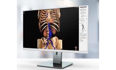 3mensio - Vascular Surgery Software