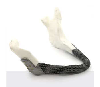 3D Medical - Mandible Implant