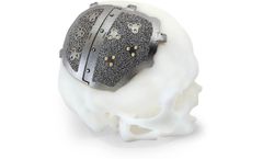 3D Medical - Cranial Implant