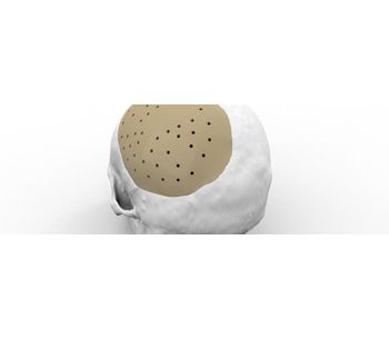 Custom Implant for Neurosurgery-2