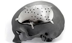 Kune - Model PEEK - Custom Implant for Neurosurgery